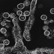 Illustration for article titled Deadly Virus Outbreak In California